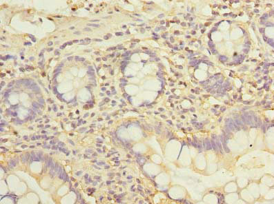 CSB-PA883437LA01HU