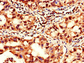 CSB-PA896902LA01HU