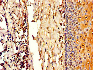 CSB-PA896912LA01HU