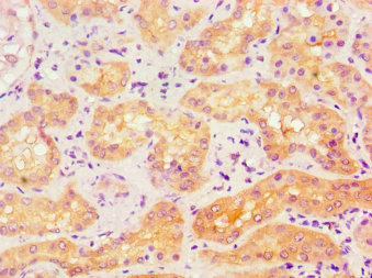 CSB-PA001257ESR2HU