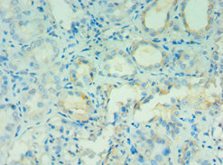 CSB-PA001463ESR2HU