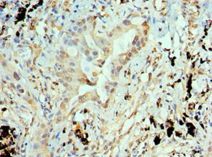 CSB-PA001832ESR1HU