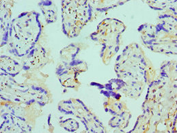 CSB-PA002485ESR1HU