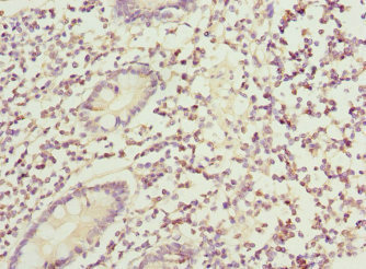 CSB-PA002678ESR1HU