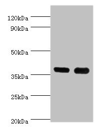 CSB-PA004889ESR2HU
