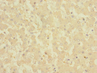 CSB-PA005983ESR1HU