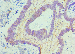 CSB-PA006138DSR2HU
