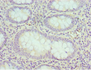 CSB-PA007537ESR1HU