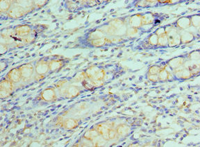 CSB-PA009666ESR1HU