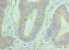 CSB-PA009666ESR1HU