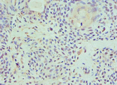 CSB-PA010143ESR2HU