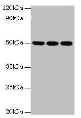 CSB-PA010143ESR2HU