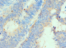 CSB-PA010365ESR2HU
