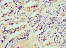 CSB-PA010365ESR2HU