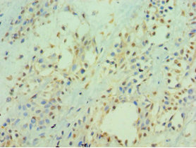 CSB-PA010950ESR2HU