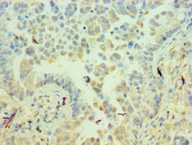CSB-PA010950ESR2HU