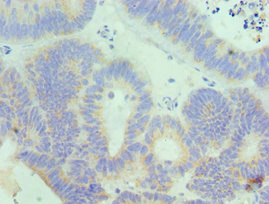 CSB-PA011611ESR2HU