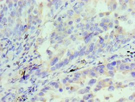 CSB-PA011611ESR2HU
