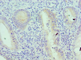 CSB-PA011611ESR2HU