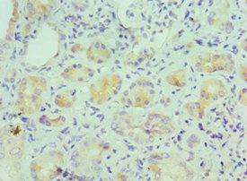 CSB-PA011675ESR2HU
