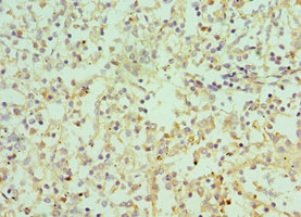 CSB-PA011675ESR2HU