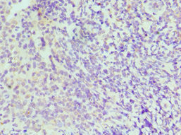 CSB-PA011819ESR2HU