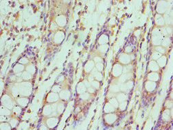 CSB-PA011819ESR2HU
