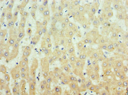 CSB-PA011829DSR1HU