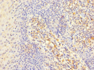 CSB-PA011874ESR1HU