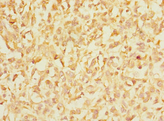 CSB-PA011874ESR1HU