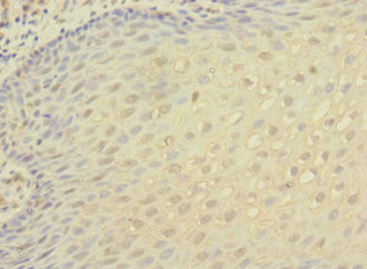 CSB-PA011879ESR1HU