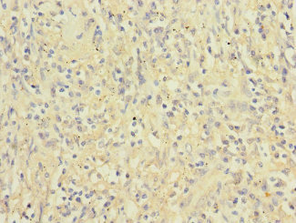 CSB-PA011879ESR1HU