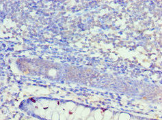 CSB-PA012086ESR2HU