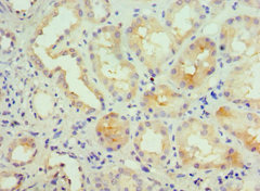 CSB-PA012086ESR2HU