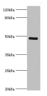 CSB-PA012086ESR2HU