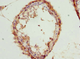 CSB-PA012894ESR2HU