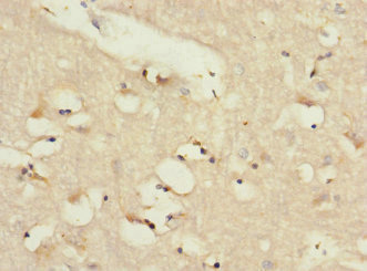 CSB-PA013060ESR2HU
