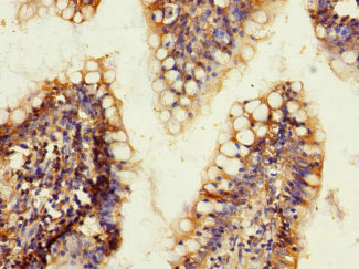 CSB-PA013060ESR2HU