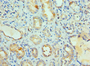 CSB-PA013254ESR1HU