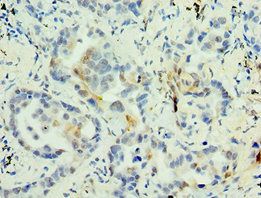 CSB-PA013332ESR2HU