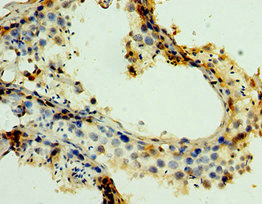 CSB-PA013332ESR2HU