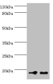 CSB-PA015521ESR1HU