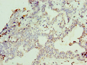 CSB-PA015535DSR2HU