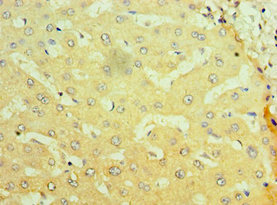 CSB-PA016048ESR1HU