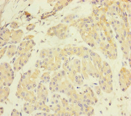 CSB-PA017321ESR1HU