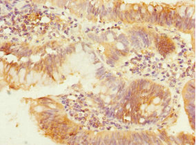 CSB-PA017802DSR2HU