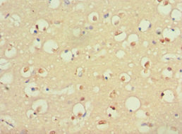CSB-PA020643ESR1HU