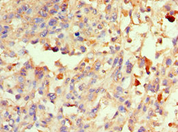 CSB-PA020643ESR1HU