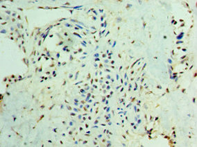 CSB-PA021788ESR2HU