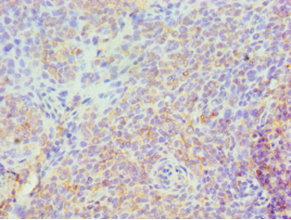CSB-PA022590ESR1HU